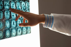 medical malpractice lawyer Oregon with a doctor pointing at a brain MRI