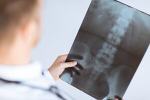 Why Choose Andersen & Linthorst as my Catastrophic Injury Lawyer in Oregon?